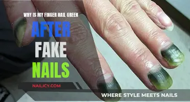 Green Nails: The Mystery After Fake Nails