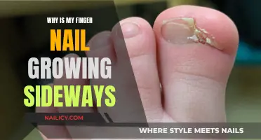 Nail Growth Anomaly: Understanding the Sideways Trend