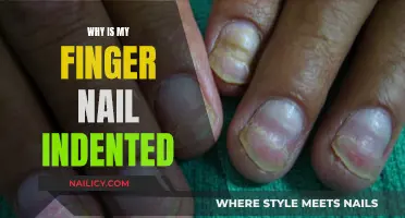 Nail Indent Mystery: Uncovering the Hidden Causes