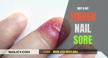 Understanding Sore Fingernails: Causes and Remedies