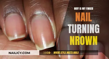 Brown Nails: What Your Fingernails Are Trying to Tell You