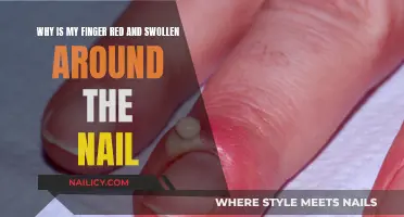 Red, Swollen Finger: Understanding the Cause and Treatment