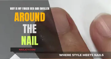Finger Swelling and Redness: What Does it Mean?