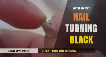 Black Toenail Causes: Understanding Discoloration and Treatment Options