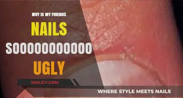 Why Your Friend's Nails Look So Awful: A Blunt Analysis