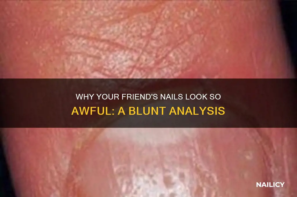 why is my friends nails soooooooooooooooooooooooooooooooooooooooo ugly