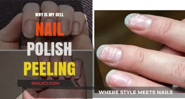 Why Gel Nail Polish Peels: Common Causes and Quick Fixes