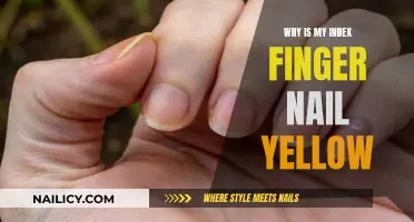 Yellow Nail Mystery: Uncovering the Causes of Discolored Index Finger