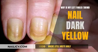 Yellow Thumbnail: Understanding the Dark Discoloration