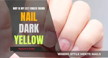 Left Thumb's Mystery: Dark Yellow Nail