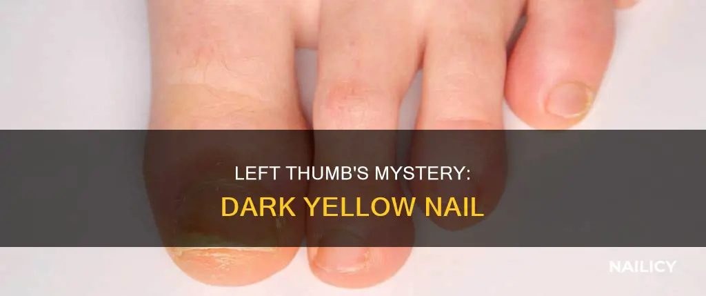 why is my left finger thumb nail dark yellow