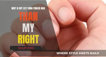 Uneven Nails: Why is My Left Ring Finger Different?