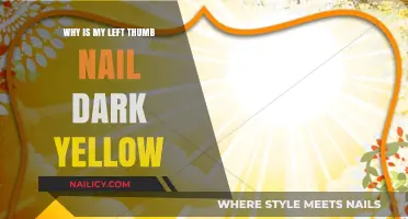 Why Is My Left Thumb Nail Dark Yellow? Causes Explained
