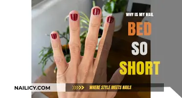 Short Nail Beds Explained: Causes and Solutions for Healthy Nails