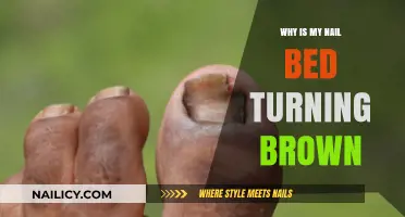 Why Is My Nail Bed Turning Brown? Causes and Solutions