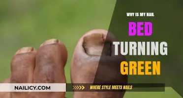 Green Nail Bed Causes: Uncovering the Surprising Reasons Behind the Discoloration