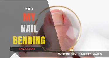 Why Are My Nails Bending? Causes and Solutions Explained