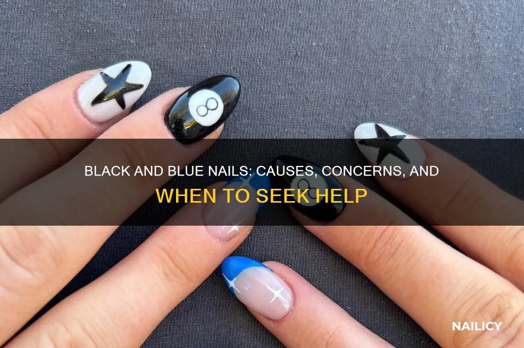 why is my nail black and blue