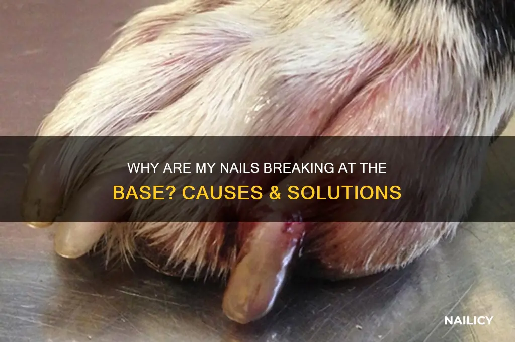 why is my nail breaking from the bottom