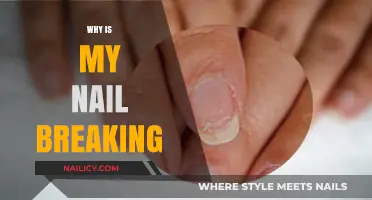 Why Are My Nails Breaking? Causes and Solutions for Brittle Nails