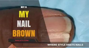 Why Is My Nail Brown? Causes, Concerns, and Solutions Explained