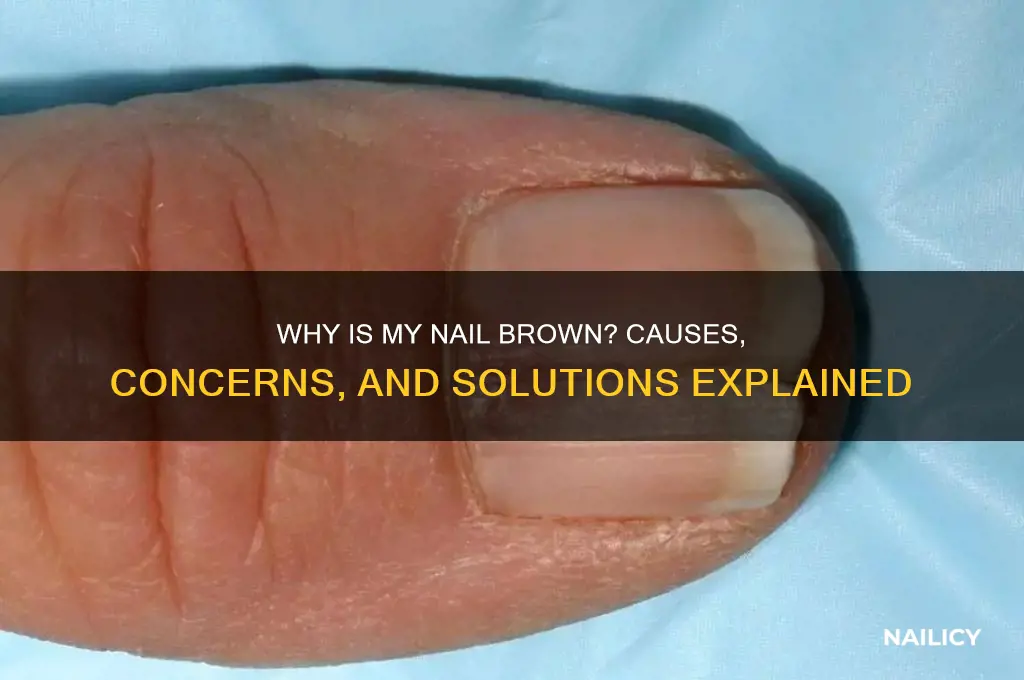 why is my nail brown
