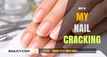 Why Are My Nails Cracking? Causes and Solutions for Brittle Nails