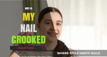 Why Is My Nail Crooked? Causes, Concerns, and Solutions Explained