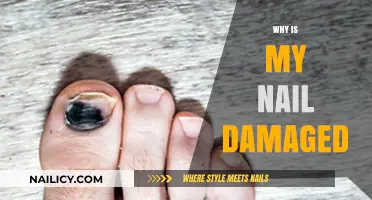 Understanding Nail Damage: Causes, Prevention, and Effective Repair Tips