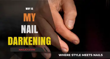 Why Are My Nails Darkening? Causes and Solutions Explained