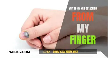 Nail Detaching: What's the Cause and How to Treat It?