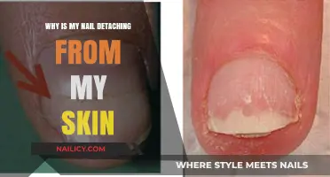 Nail Detaching from Skin: Causes, Concerns, and Effective Solutions