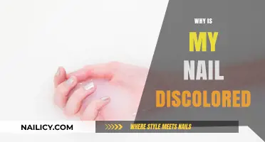 Why Is My Nail Discolored? Causes, Concerns, and Solutions Explained