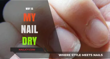 Why Are My Nails Dry? Causes, Prevention, and Hydration Tips