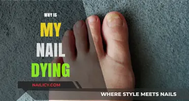 Why Is My Nail Dying? Causes, Symptoms, and Effective Treatments