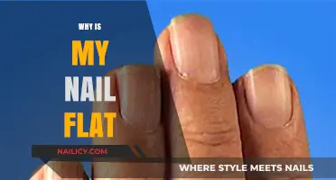 Why Are My Nails Flat? Causes and Solutions Explained