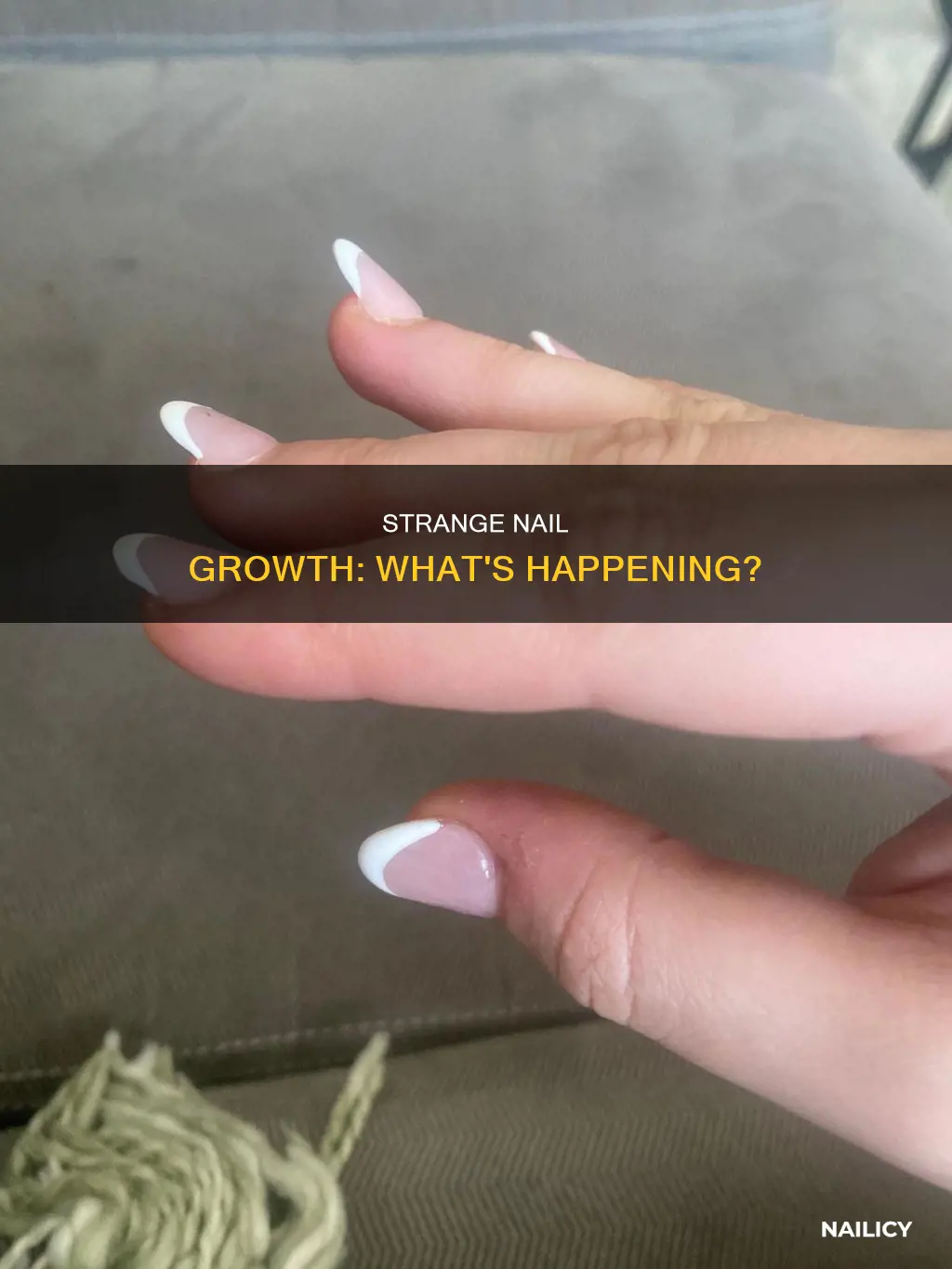 why is my nail growing funny