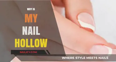 Why Are My Nails Hollow? Causes, Concerns, and Solutions Explained