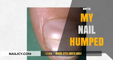 Understanding Hump Nails: Causes, Concerns, and Effective Treatment Options