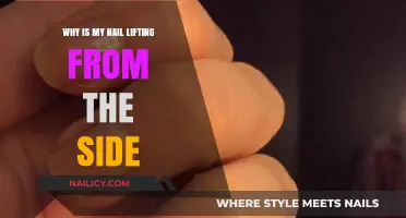 Why Is My Nail Lifting from the Side? Causes and Solutions