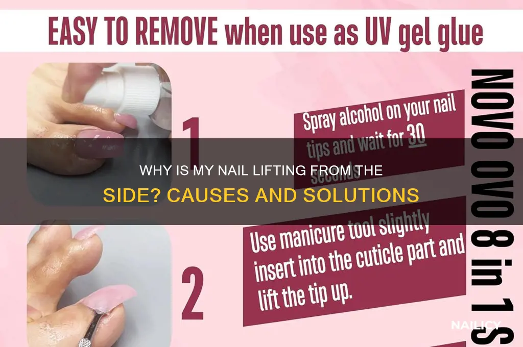 why is my nail lifting from the side
