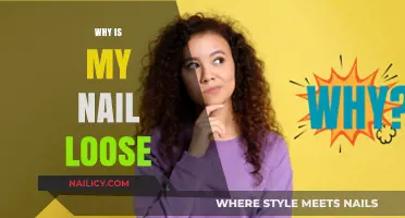 Why Is My Nail Loose? Causes, Concerns, and Quick Remedies