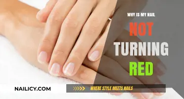 Why Your Nail Isn't Turning Red: Causes and Solutions Explained