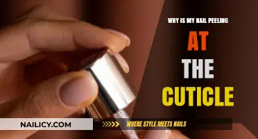 Why Your Nail Peels at the Cuticle: Causes and Solutions