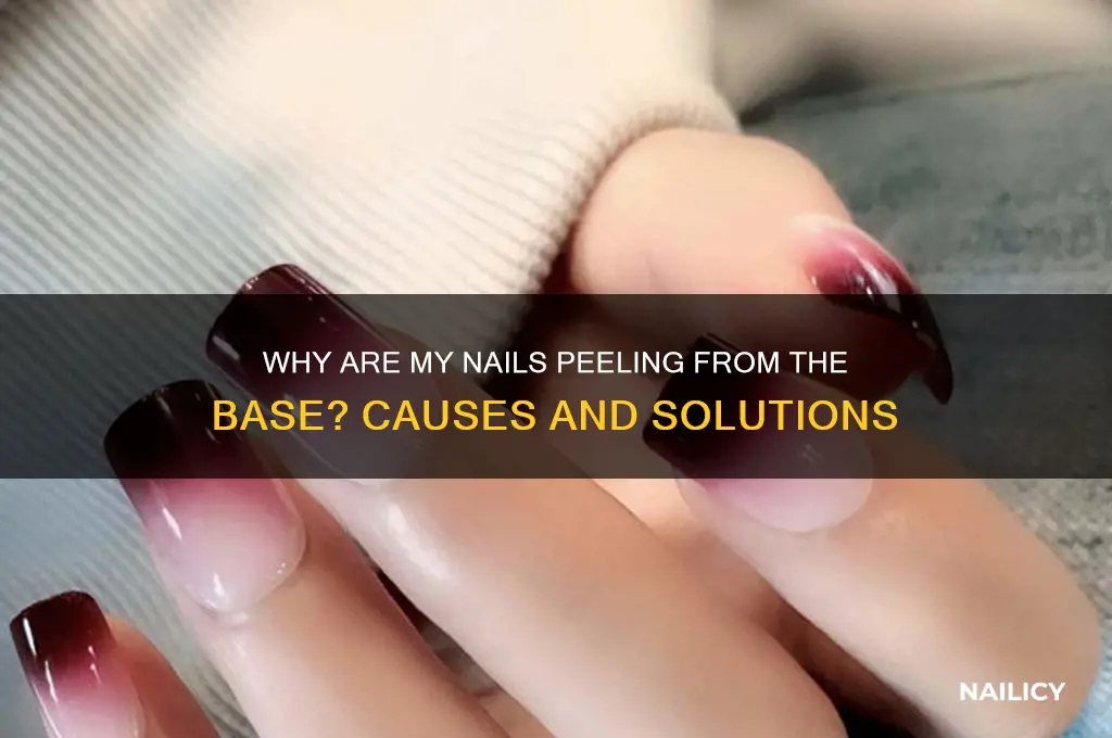 why is my nail peeling from the base