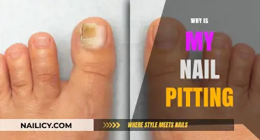 Understanding Nail Pitting: Causes, Concerns, and Effective Treatment Options