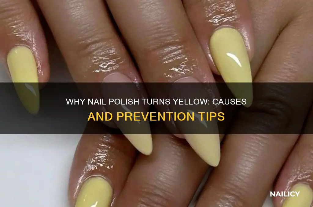 why is my nail polish turning yeloow