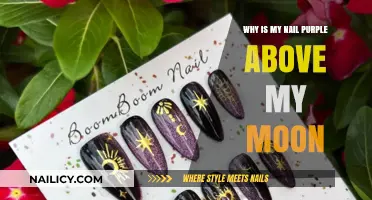 Purple Nail Above the Moon: Causes and Concerns Explained