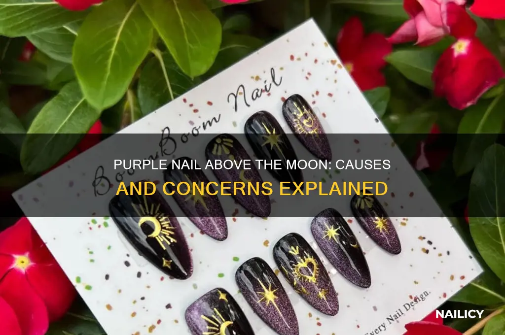 why is my nail purple above my moon