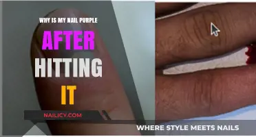 Why Your Nail Turns Purple After an Injury: Explained